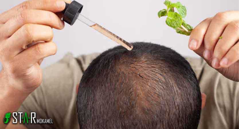 روش‌های پیشگیری از ریزش مو در مصرف مکمل‌ها